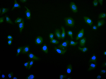 RPS6KA3 Antibody