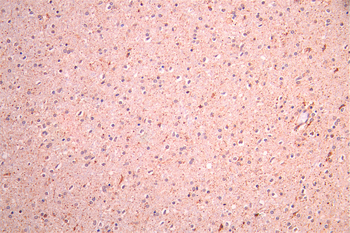 Il1b Antibody