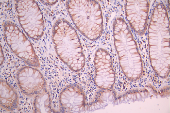 APOB Antibody
