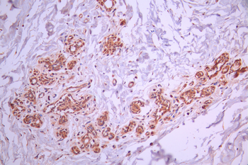 DCAF7 Antibody