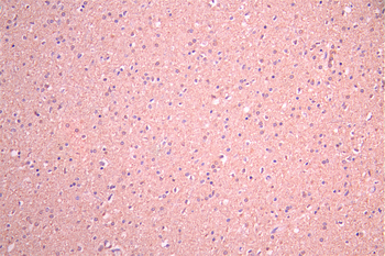 NPY5R Antibody