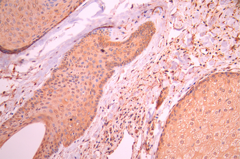 NPY5R Antibody