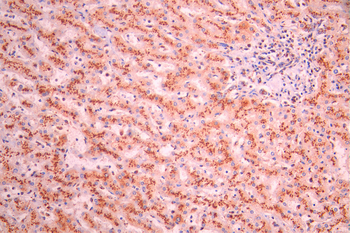 TGOLN2 Antibody