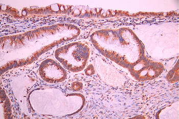 TGOLN2 Antibody