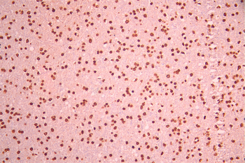 CLP1 Antibody