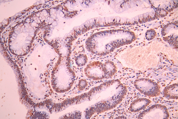 CLP1 Antibody