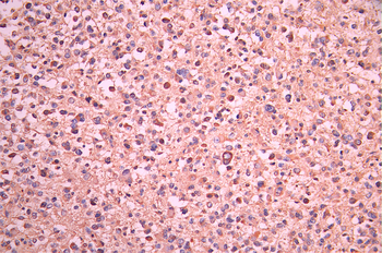 OSBPL1A Antibody