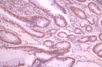 CPSF3 Antibody