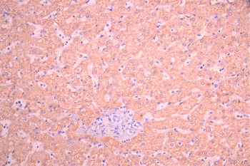 FTCD Antibody