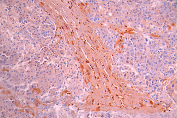FTCD Antibody