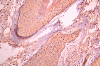 CTNNBIP1 Antibody