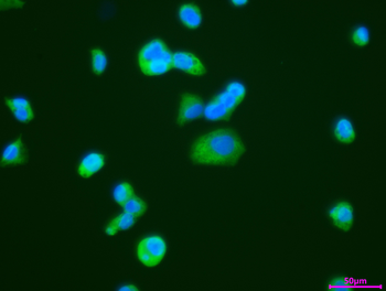 CTNNBIP1 Antibody
