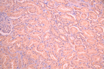 TNFRSF11B Antibody