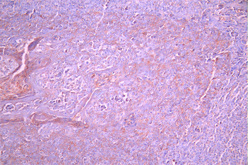 IGHM Antibody