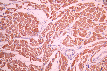 ACTN2 Antibody