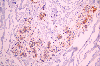 ACTN2 Antibody