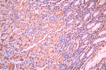 PDIA6 Antibody