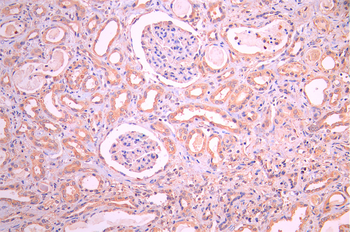 UBE4A Antibody