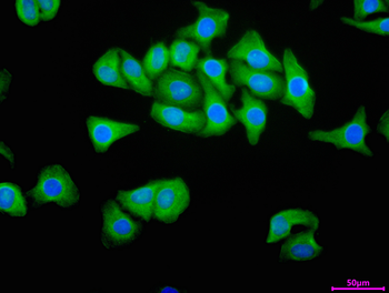UBE4A Antibody