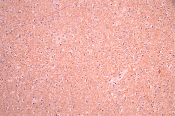 NCS1 Antibody