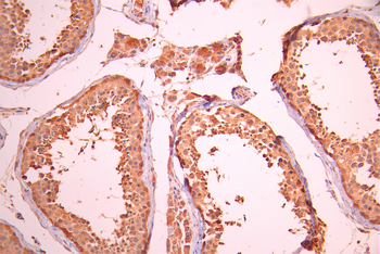 AP2S1 Antibody