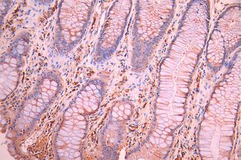 AP2S1 Antibody