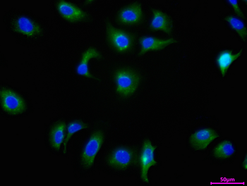 AP2S1 Antibody
