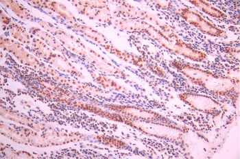 EXOSC7 Antibody