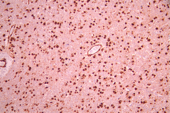 QKI Antibody