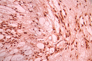 QKI Antibody
