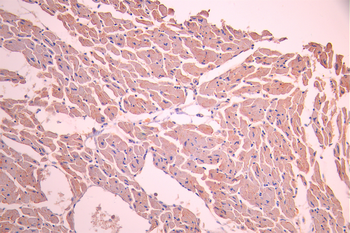 CAV3 Antibody