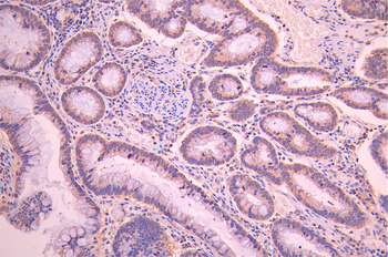 CAV3 Antibody