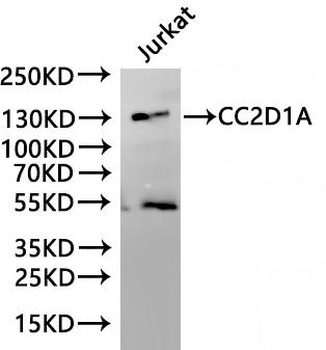 CC2D1A Antibody