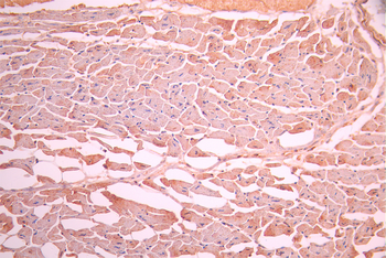 CTNNA3 Antibody