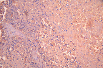 CTNNA3 Antibody