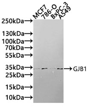 GJB1 Antibody