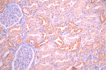GJB1 Antibody