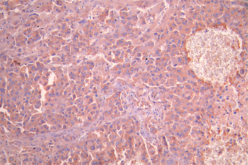 GJB1 Antibody