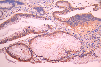 PDLIM1 Antibody