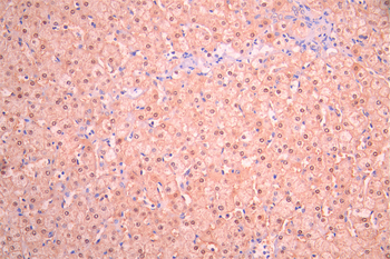 GK Antibody