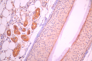 KLK5 Antibody