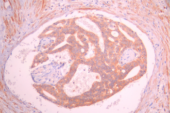 KLK5 Antibody