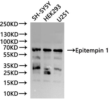 LGI1 Antibody