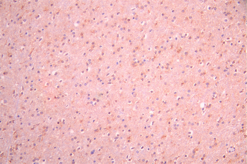 LGI1 Antibody