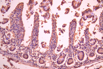 TNFRSF19 Antibody