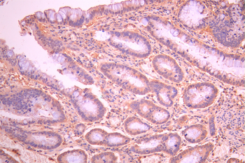 TNFRSF19 Antibody