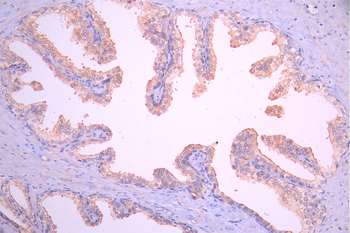 GOT2 Antibody