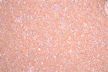 STX1A Antibody