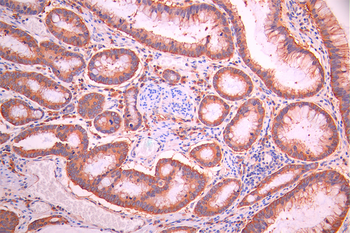 STX1A Antibody