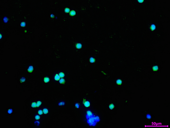 ALKBH1 Antibody